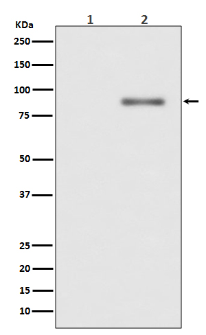 Phospho-PKC alpha (Thr638) Rabbit mAb