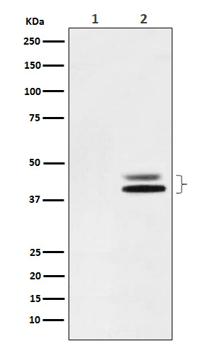 Phospho-ERK1/2 (Thr202/Thr185) Rabbit mAb