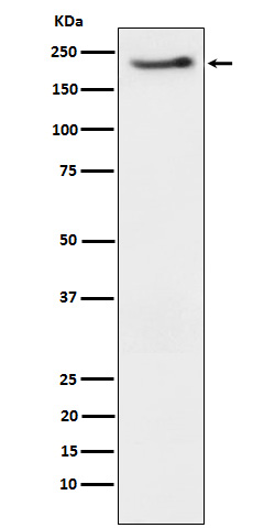 Phospho-ErbB3 (Tyr1222) Rabbit mAb