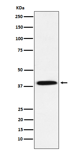 Phospho-IKB alpha (Ser36) Rabbit mAb