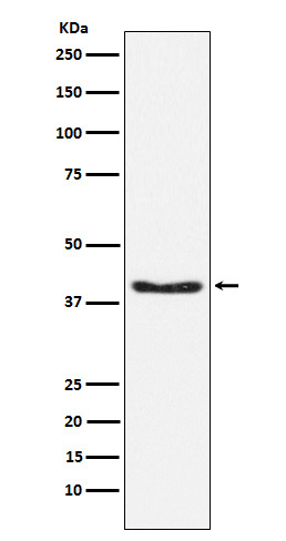 Phospho-PDHA1 (Ser293) Rabbit mAb