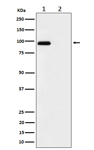 Phospho-FGFR3 (Tyr724) Rabbit mAb