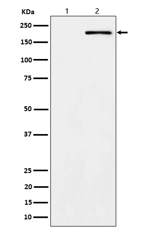 Phospho-ErbB2 (Tyr1139) Rabbit mAb