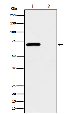 Phospho-Chk2 (Thr68) Rabbit mAb