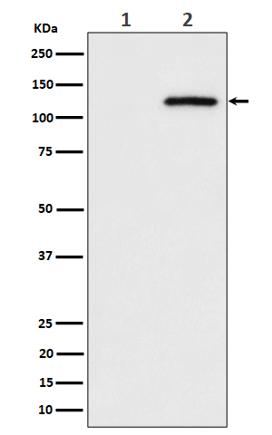 Phospho-CBL (Ser669) Rabbit mAb