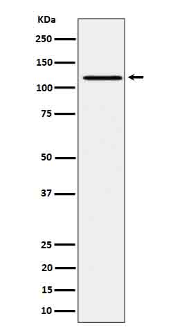 Phospho-JAK1 (Tyr1034/Tyr1035) Rabbit mAb