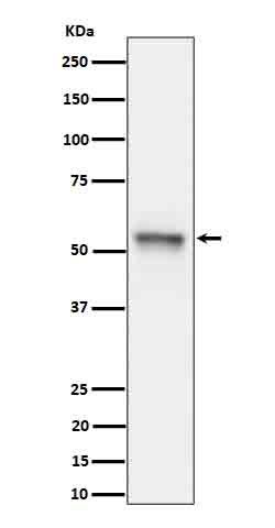 Phospho-Tau (Ser199) Rabbit mAb