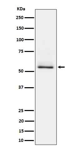 Phospho-Tau (Ser404) Rabbit mAb