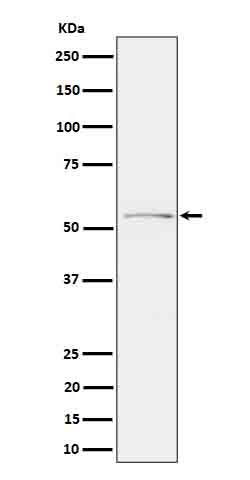 Phospho-Tau (Ser214) Rabbit mAb