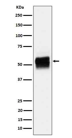 Phospho-Tau (Ser202) Rabbit mAb