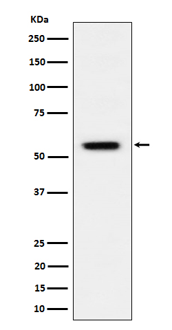 Phospho-Vimentin (Ser39) Rabbit mAb