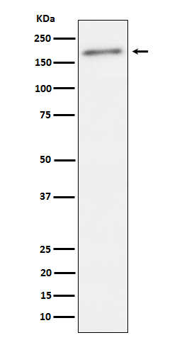 Phospho-ErbB 2(Tyr1221 /Tyr1222)  Rabbit mAb 