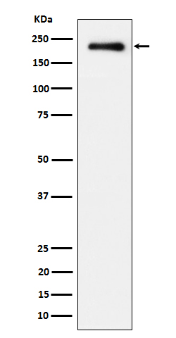 Phospho-EGFR (Tyr845) Rabbit mAb