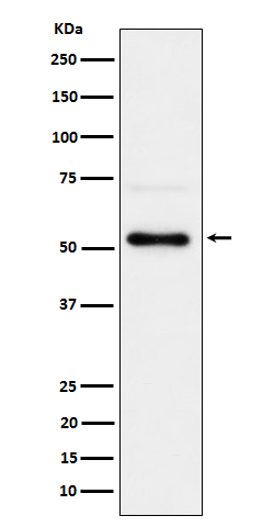 Phospho-Chk1 (Serer280) Rabbit mAb