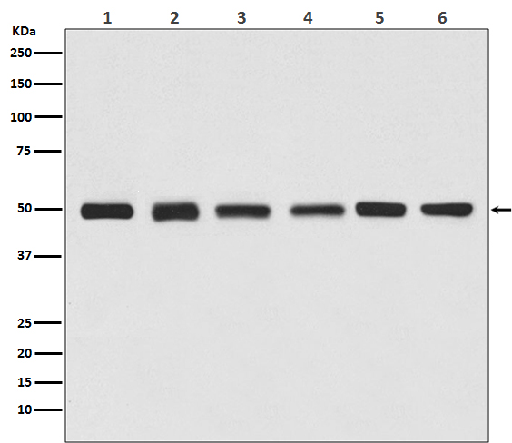 beta III Tubulin Rabbit mAb (HRP)