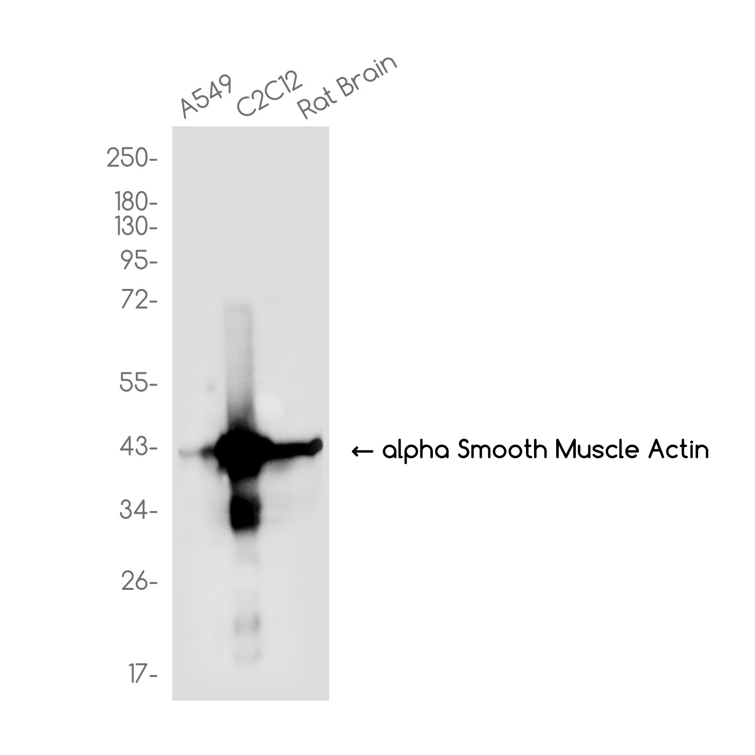 alpha Smooth Muscle Actin Rabbit mAb