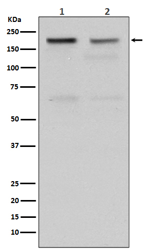 Topoisomerase II alpha Rabbit mAb