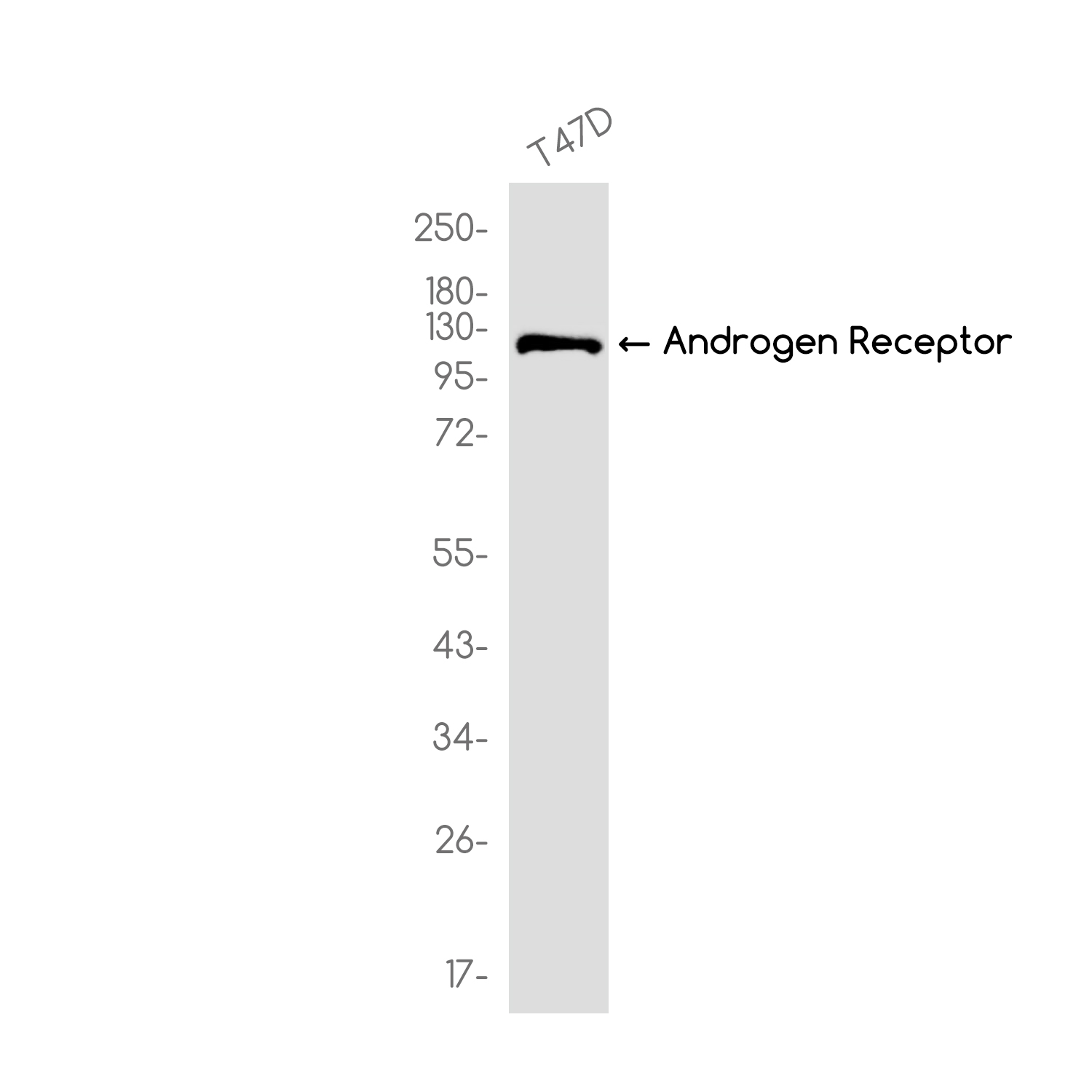 Androgen Receptor Rabbit mAb