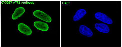 ATF2 Rabbit mAb