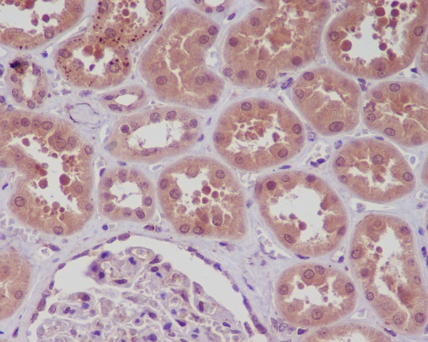 NF-KB p105 Rabbit mAb