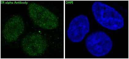 Estrogen Receptor alpha Rabbit mAb