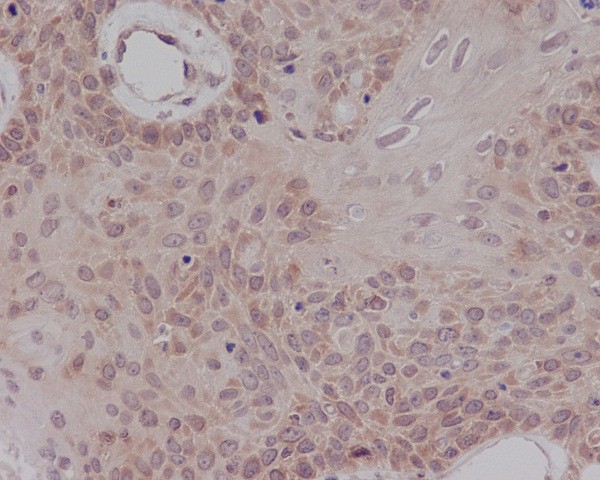 Estrogen Receptor alpha Rabbit mAb