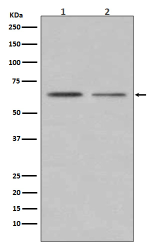 Estrogen Receptor alpha Rabbit mAb