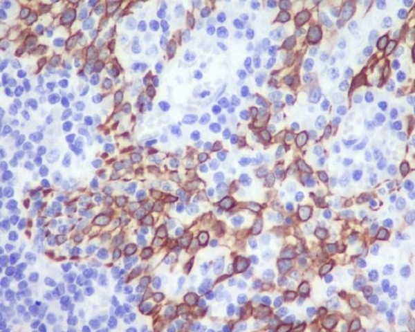 CCR2 Rabbit mAb