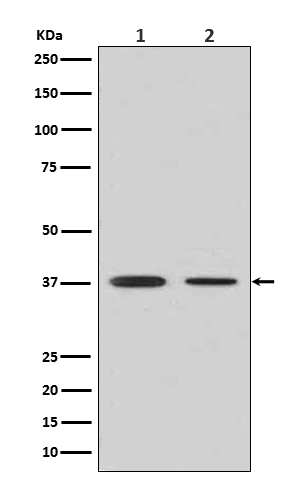 Liver Arginase Rabbit mAb