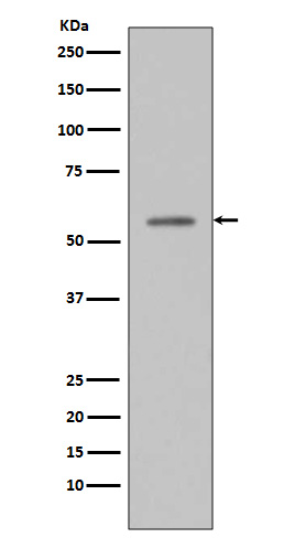 Phospho-p53 (Ser33) Rabbit mAb