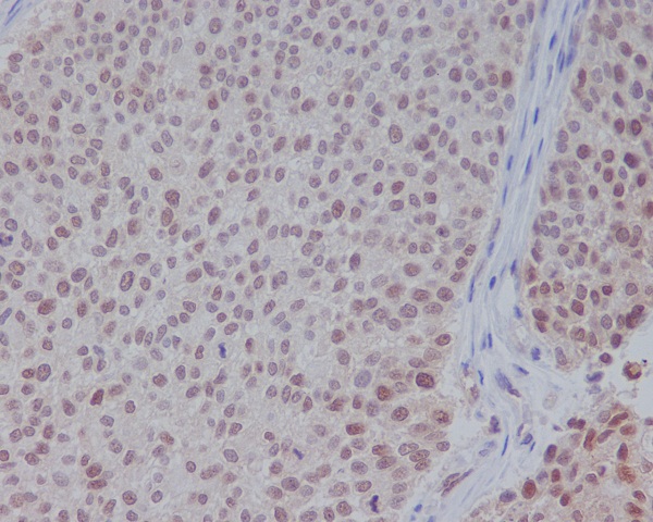 ERK1 Rabbit mAb