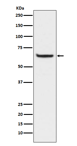 Phospho-NF-KB p65 (Ser529) Rabbit mAb