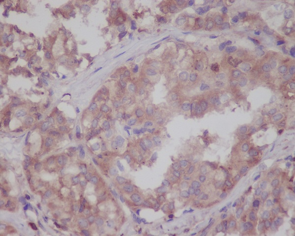 LRRK2 Rabbit mAb