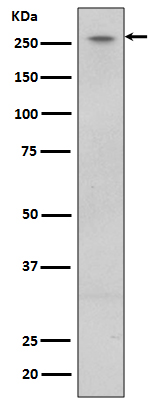 LRRK2 Rabbit mAb