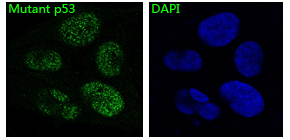 p53 Rabbit mAb