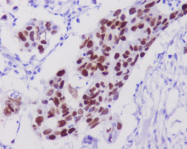 p53 Rabbit mAb