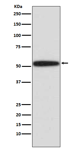 p53 Rabbit mAb