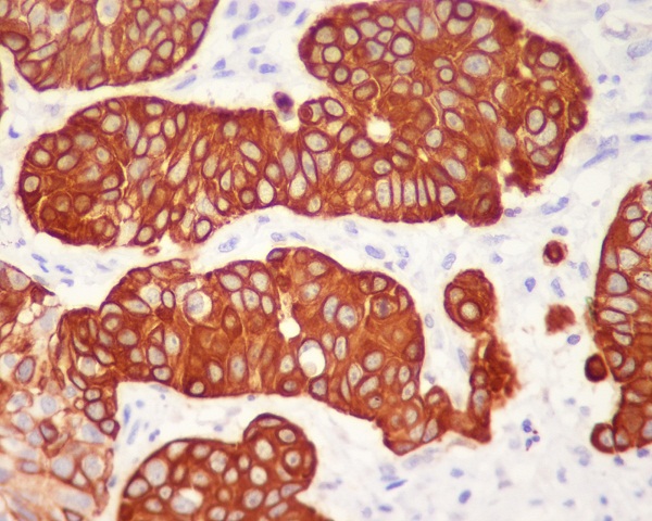 Cytokeratin 5 Rabbit mAb