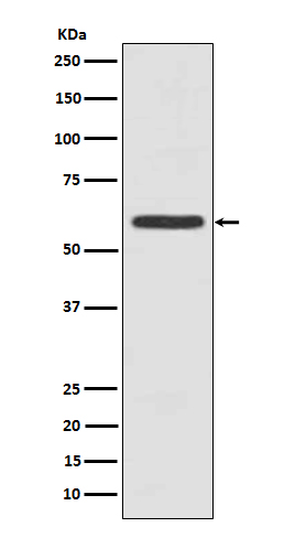 Cytokeratin 5 Rabbit mAb