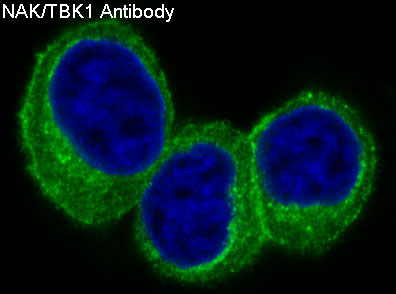 TBK1 Rabbit mAb