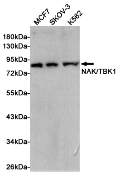 TBK1 Rabbit mAb