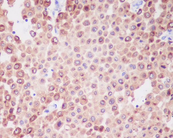 Melanocyte Protein PMEL Rabbit mAb