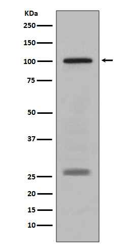 Melanocyte Protein PMEL Rabbit mAb