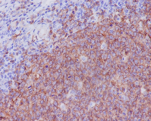 CD20 Rabbit mAb