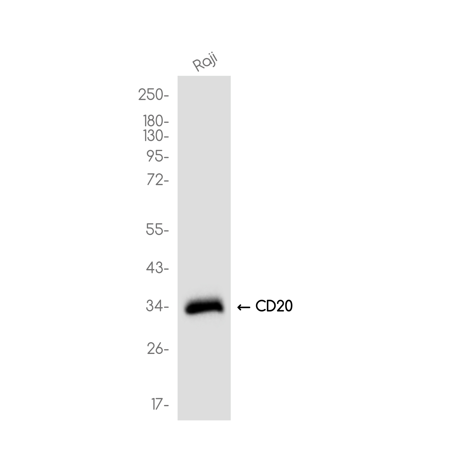 CD20 Rabbit mAb