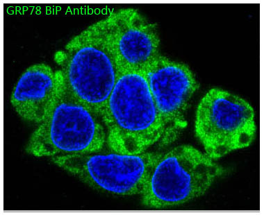 GRP78 BiP Rabbit mAb