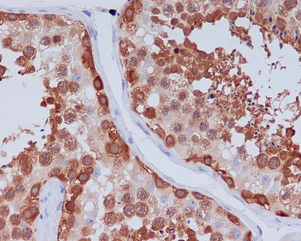 Hsp90 beta Rabbit mAb