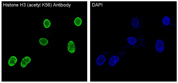 Acetyl-Histone H3 (Lys56) Rabbit mAb