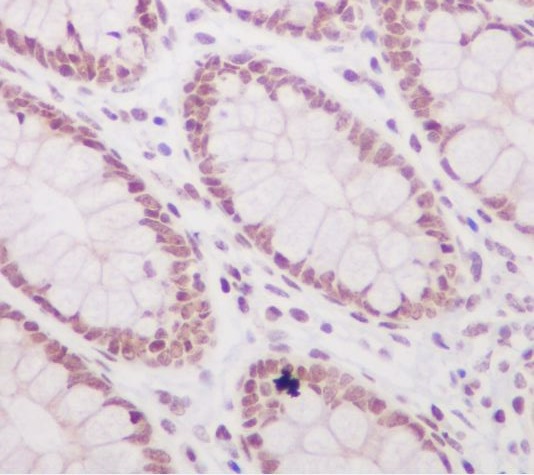 Acetyl-Histone H3 (Lys56) Rabbit mAb