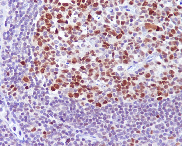 Bcl6 Rabbit mAb